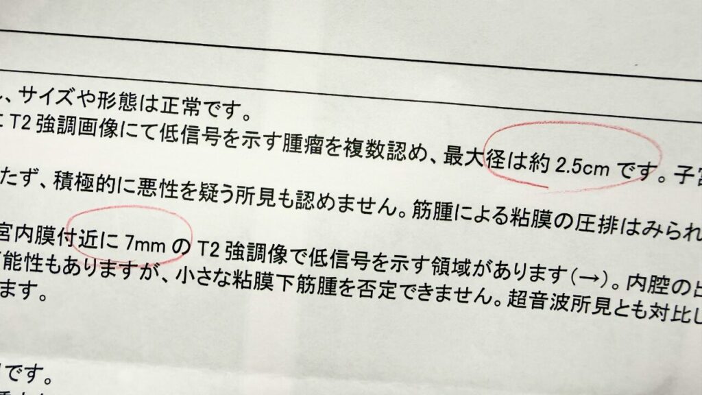 子宮をMRIでみてもらった結果。子宮の外側に筋腫が複数で最大が約2.5mm。内膜付近に7mmの筋腫。